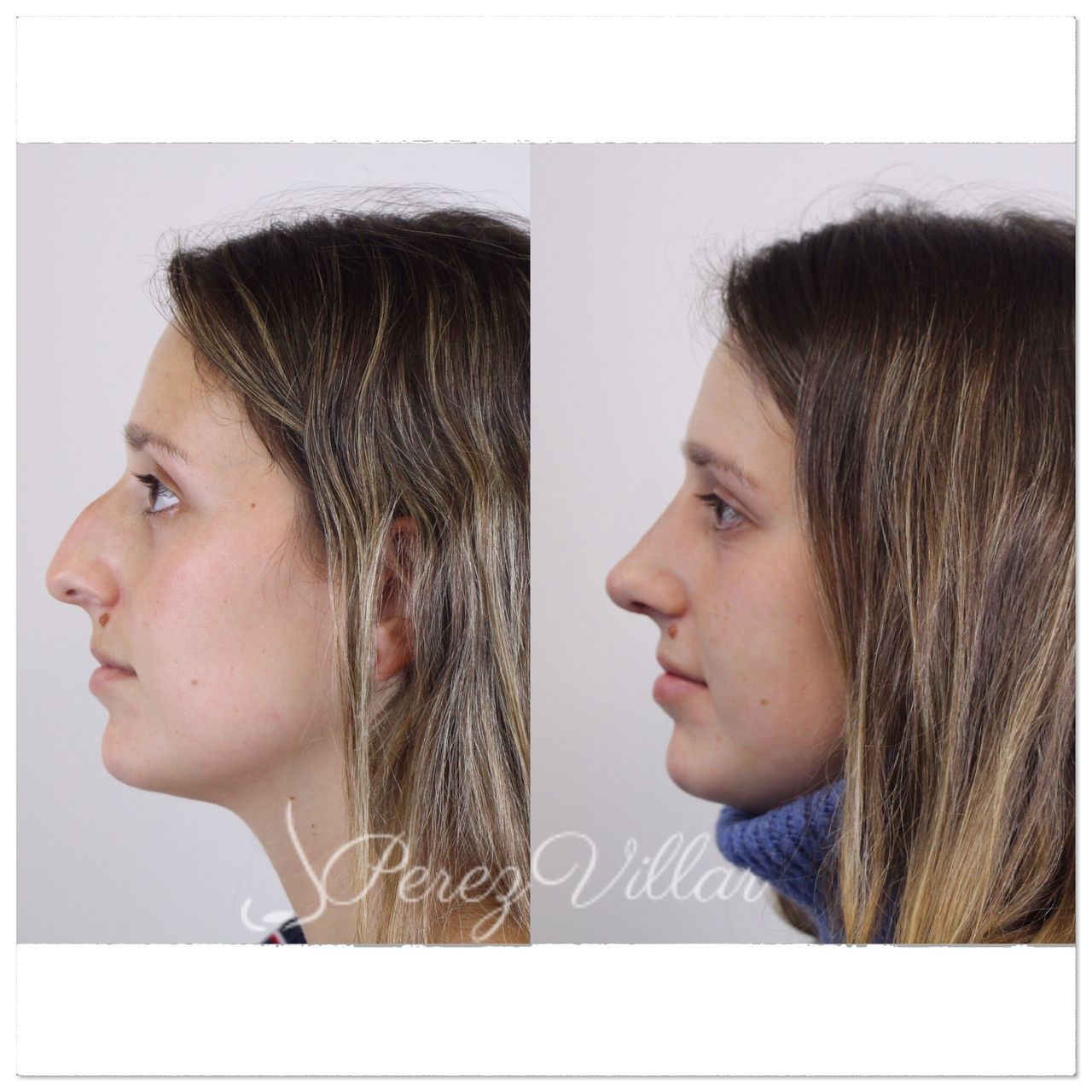 Alvaro Perez Villar-3