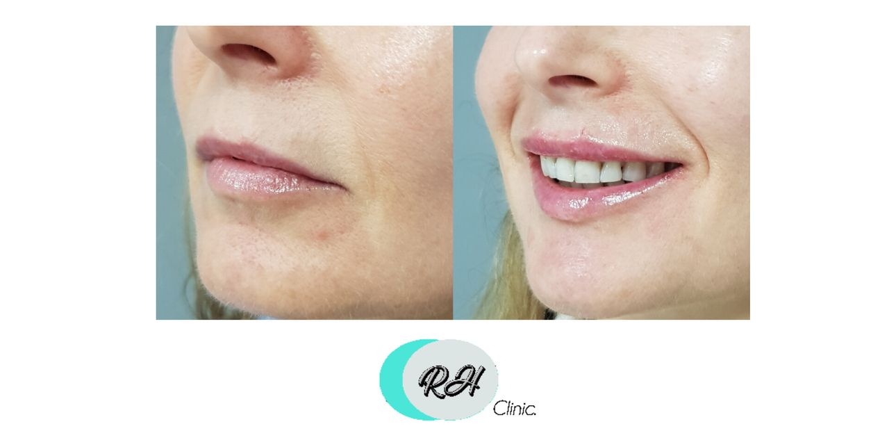 Rosalba Herrero Zerpa-626