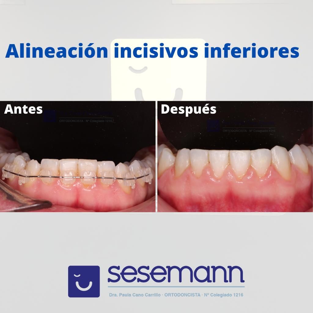 Paula Cano Carrillo-63