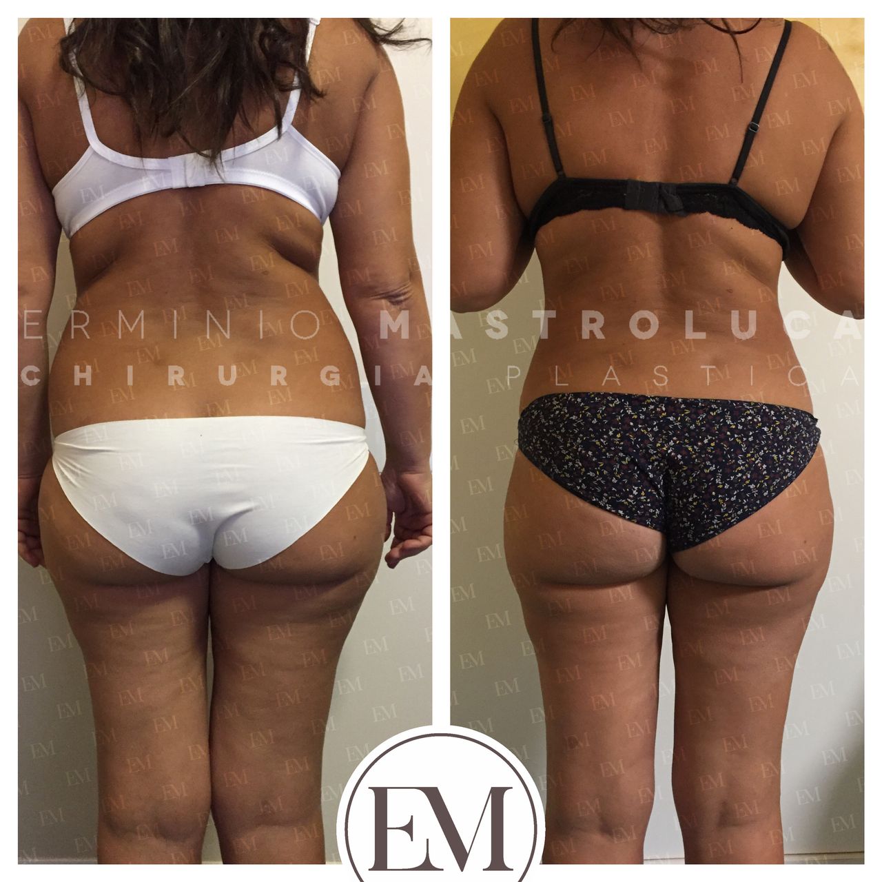 Erminio Mastroluca-4