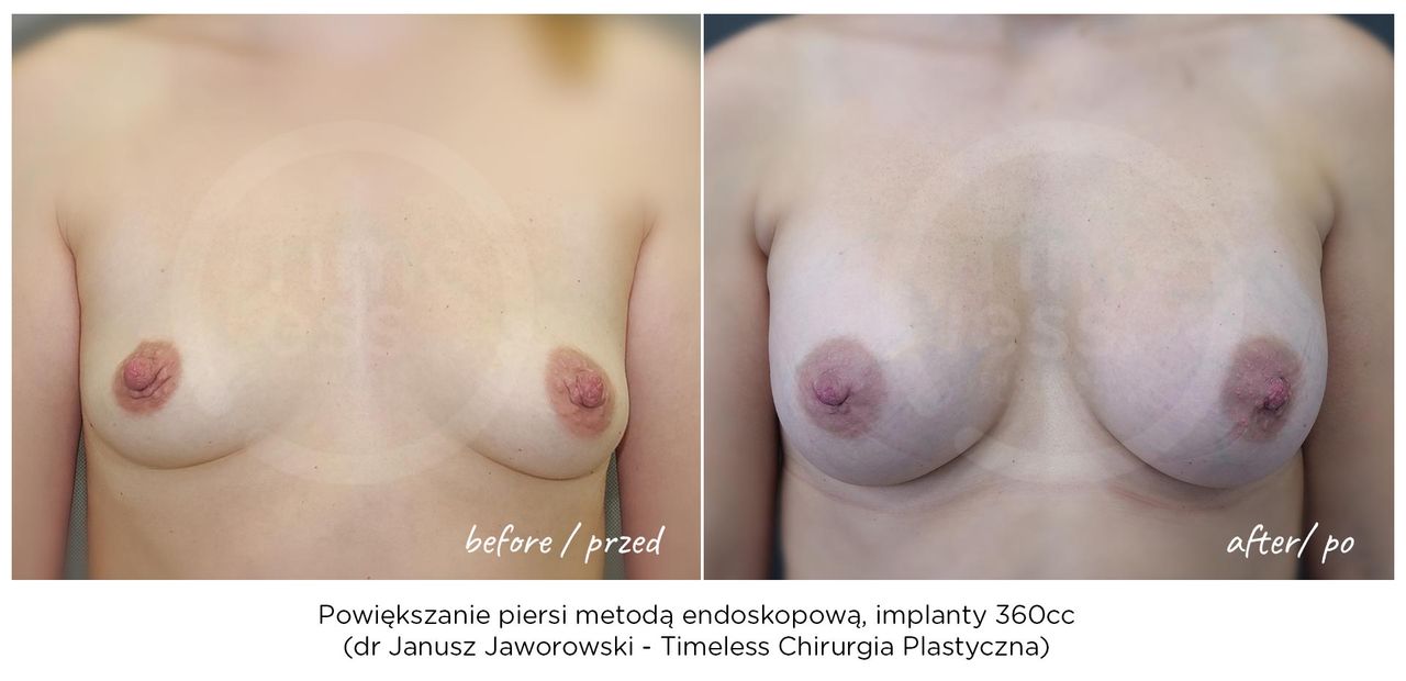 Janusz Jaworowski-169