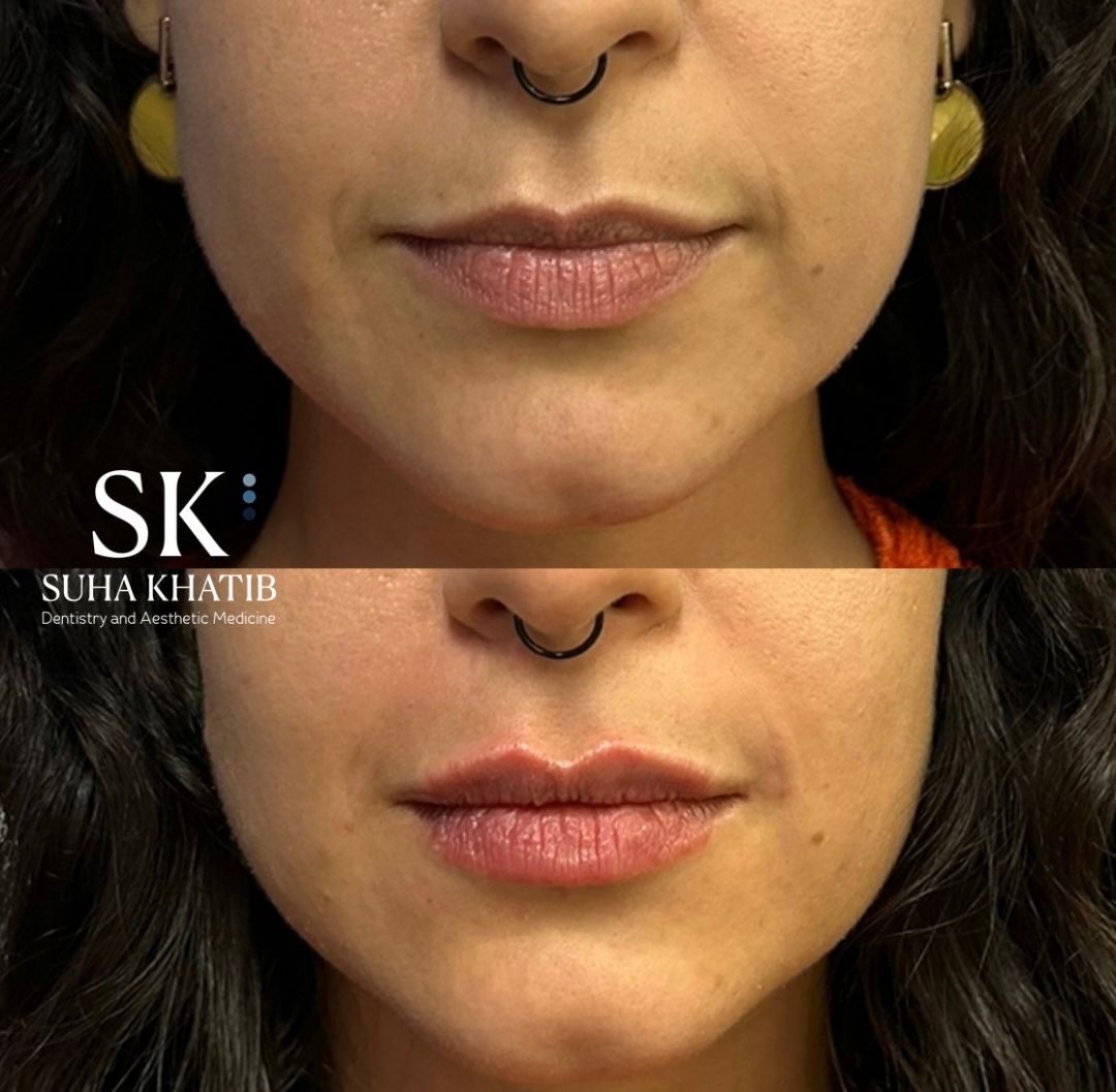 Suha Khatib-4