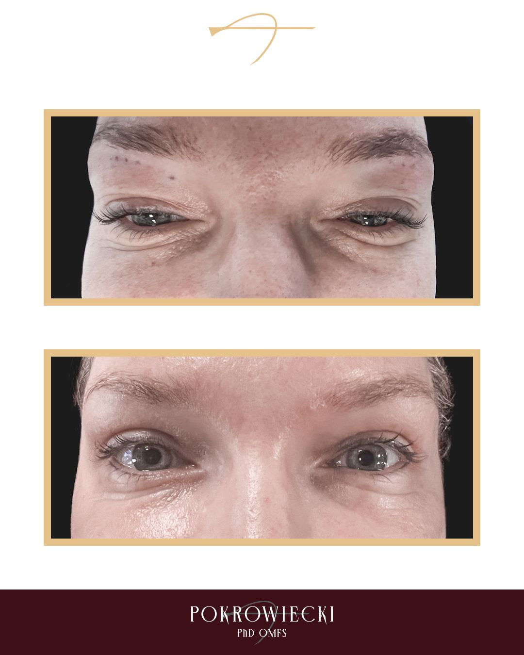 Rafał Pokrowiecki-42