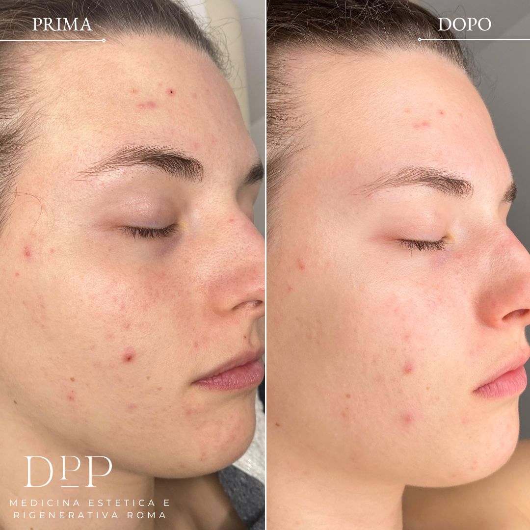 Davide Prosperi Porta-12