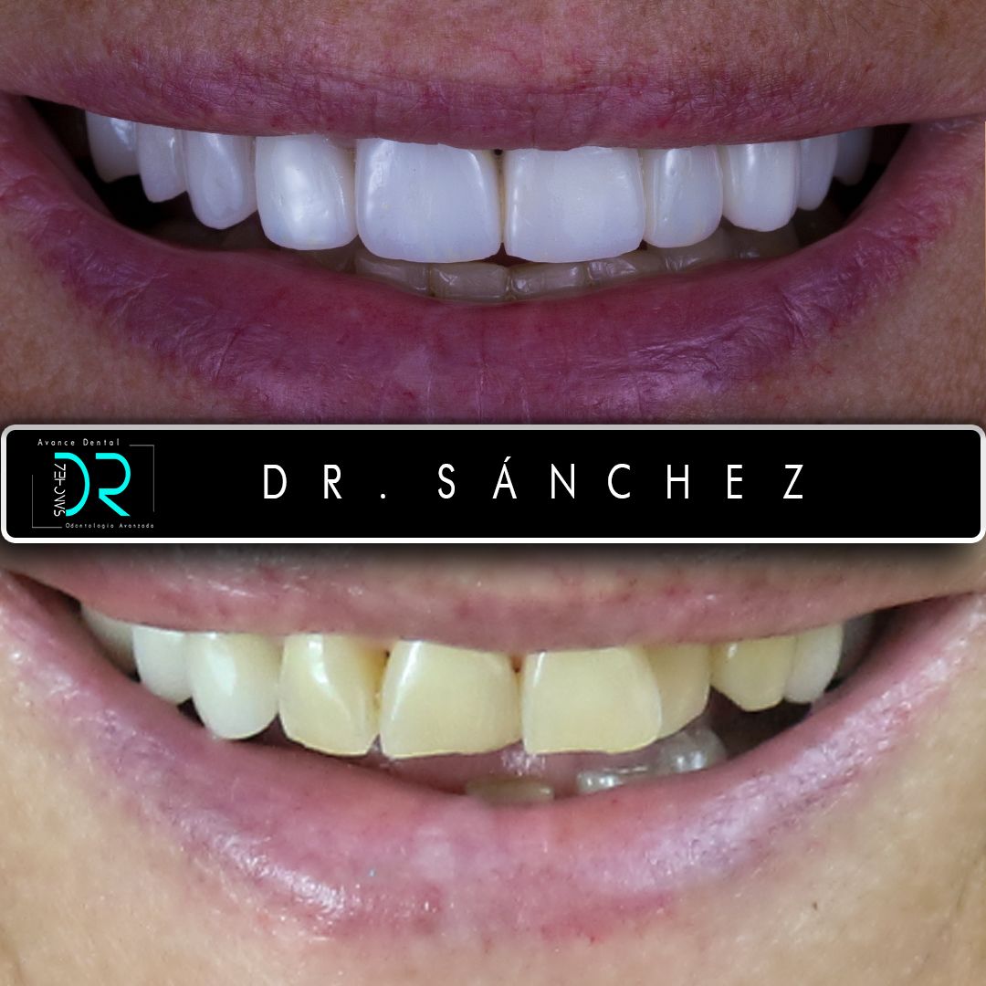 Juan Carlos Sánchez Pérez-12