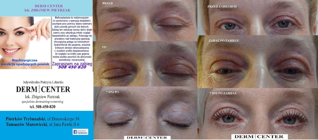 Zbigniew Pietrzak-14