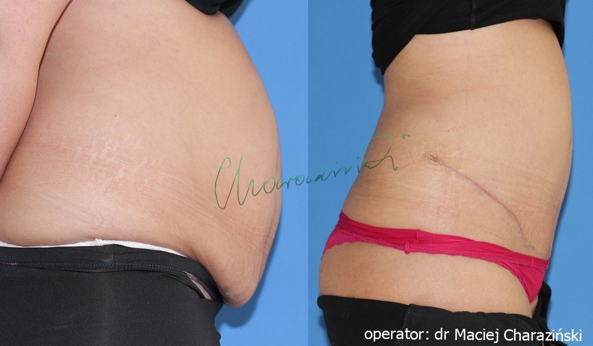 Maciej Charaziński-10