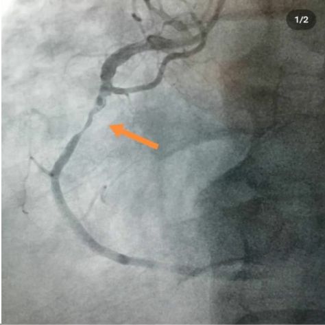 Hüseyin Onur Şahin-15