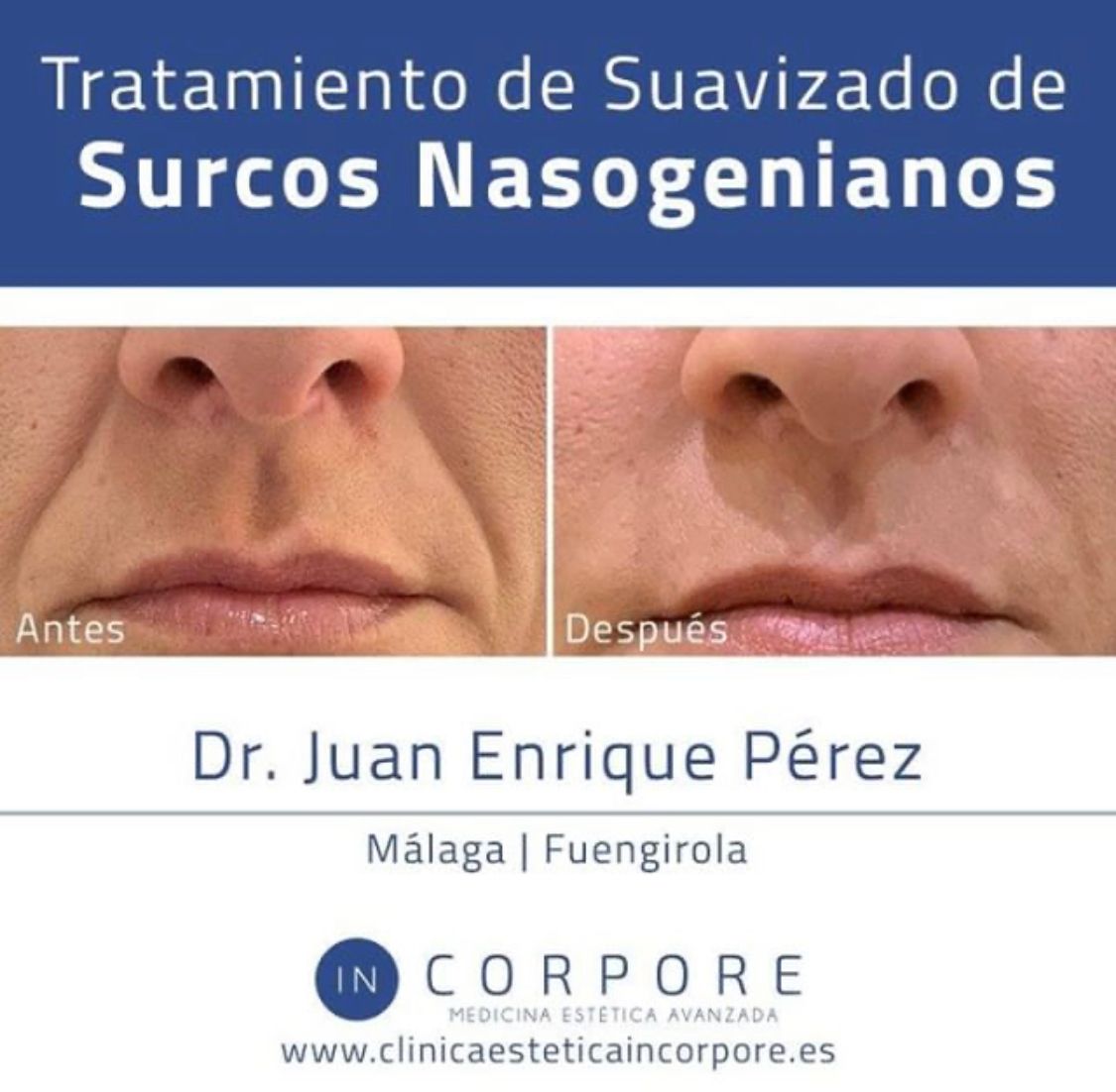 Juan Enrique Pérez Enríquez-18