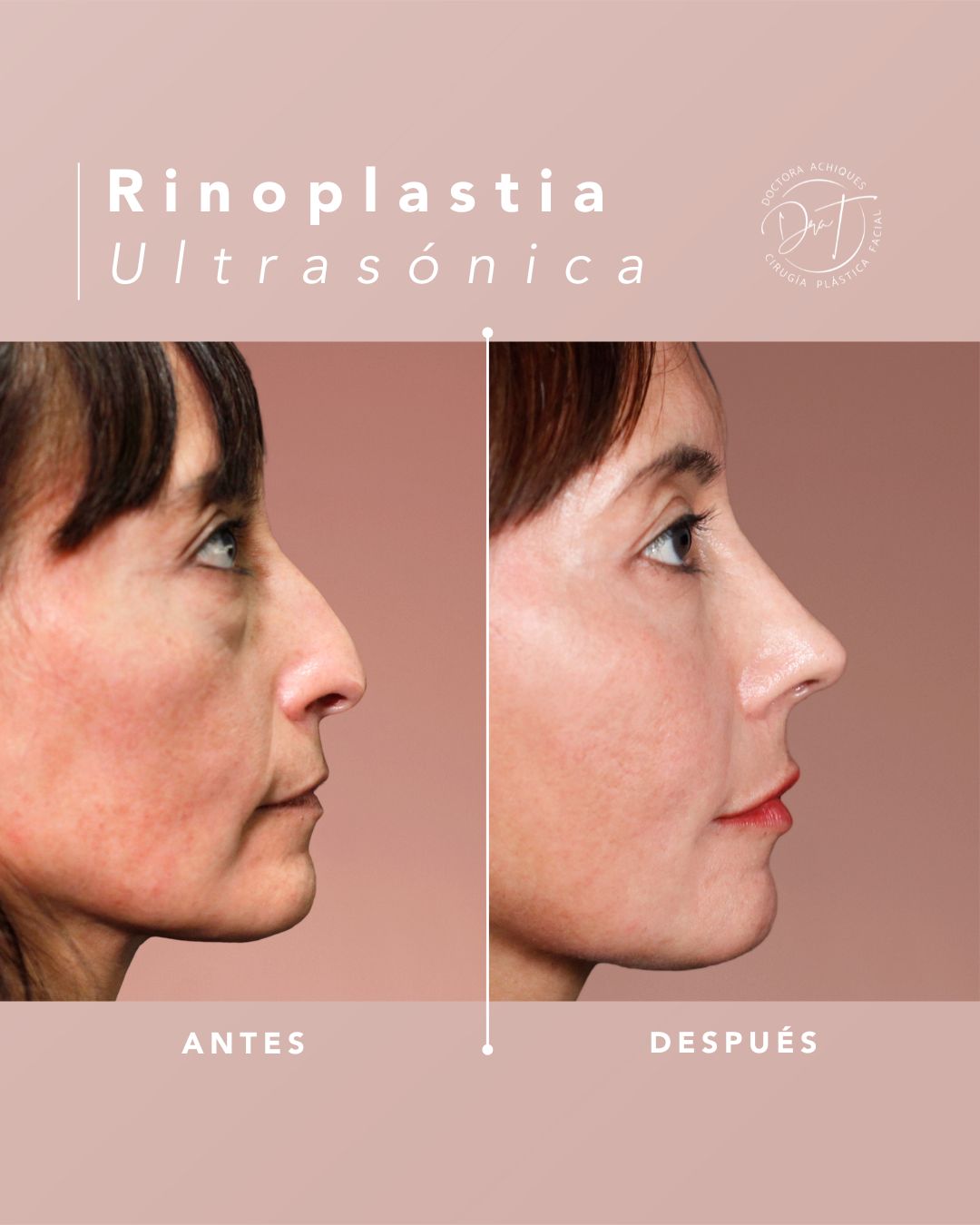 María Teresa Achiques-3