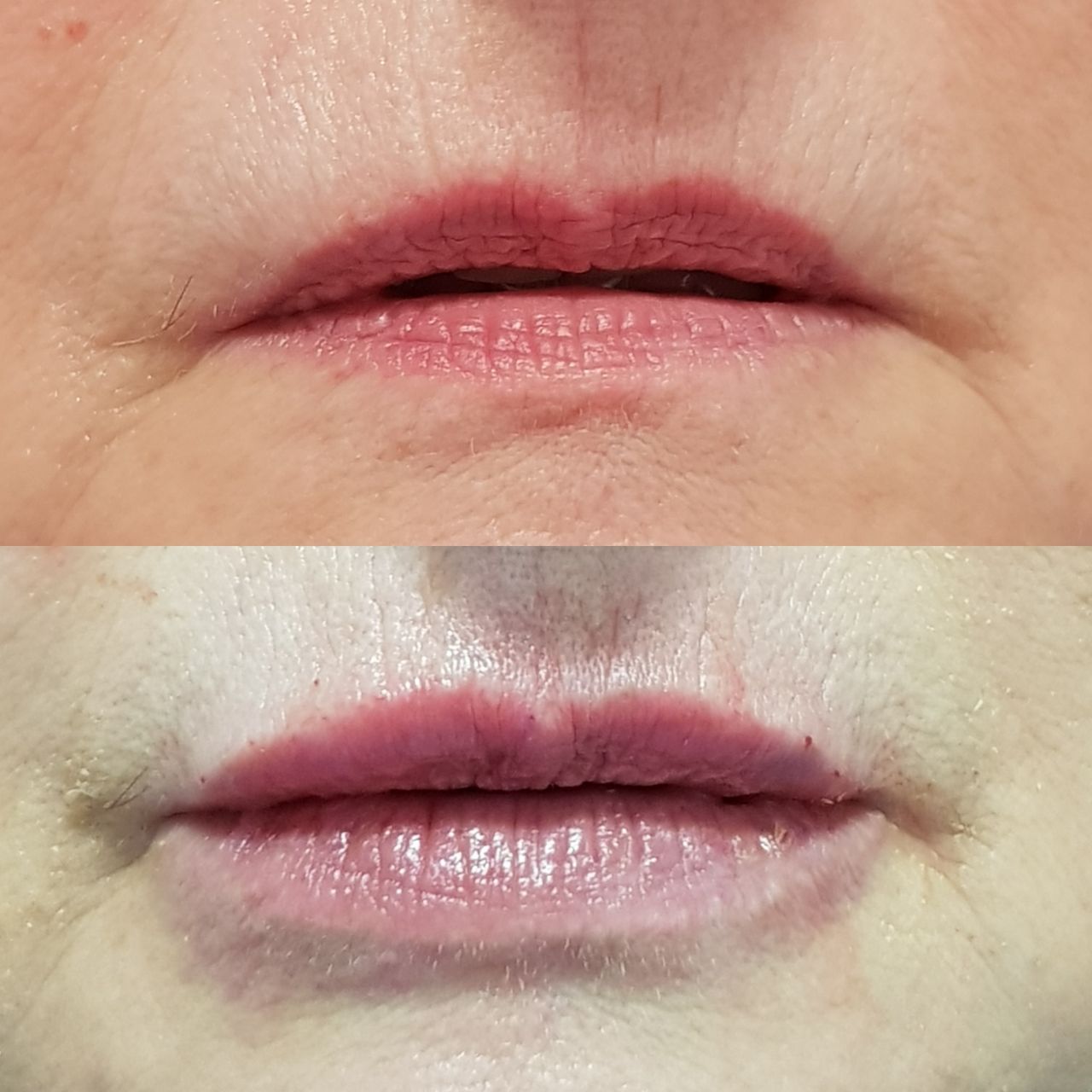 Rosalba Herrero Zerpa-314