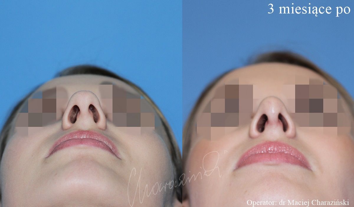 Maciej Charaziński-67