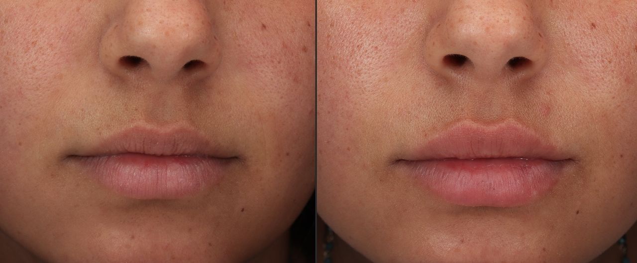 Giordano Vespasiani-25