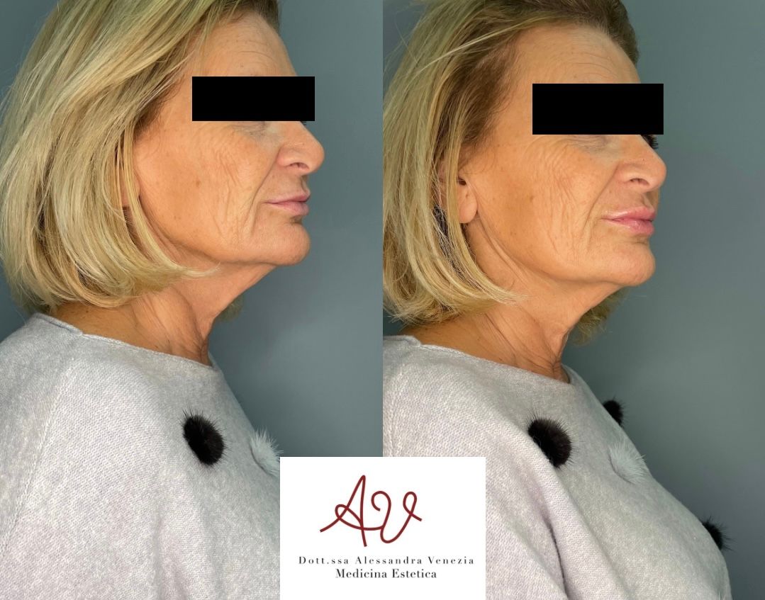 Alessandra Venezia-31