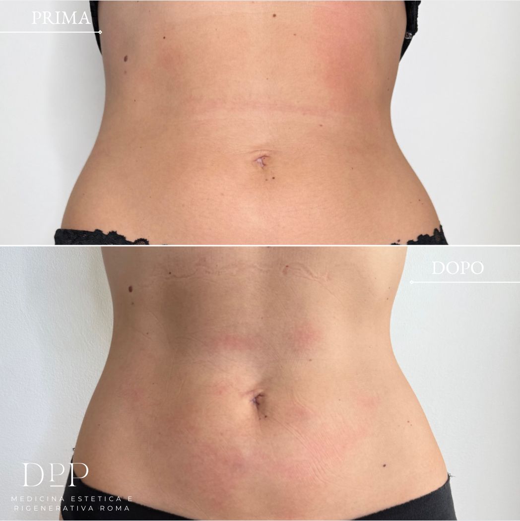 Davide Prosperi Porta-11