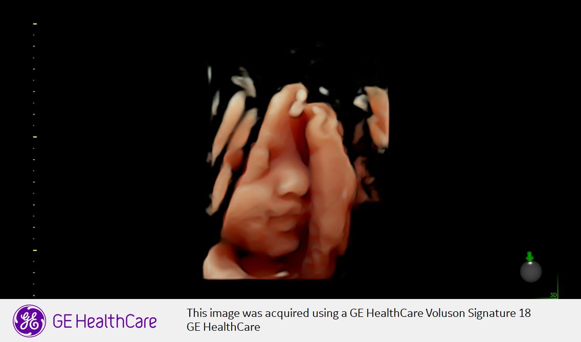 Domenico Incandela-16