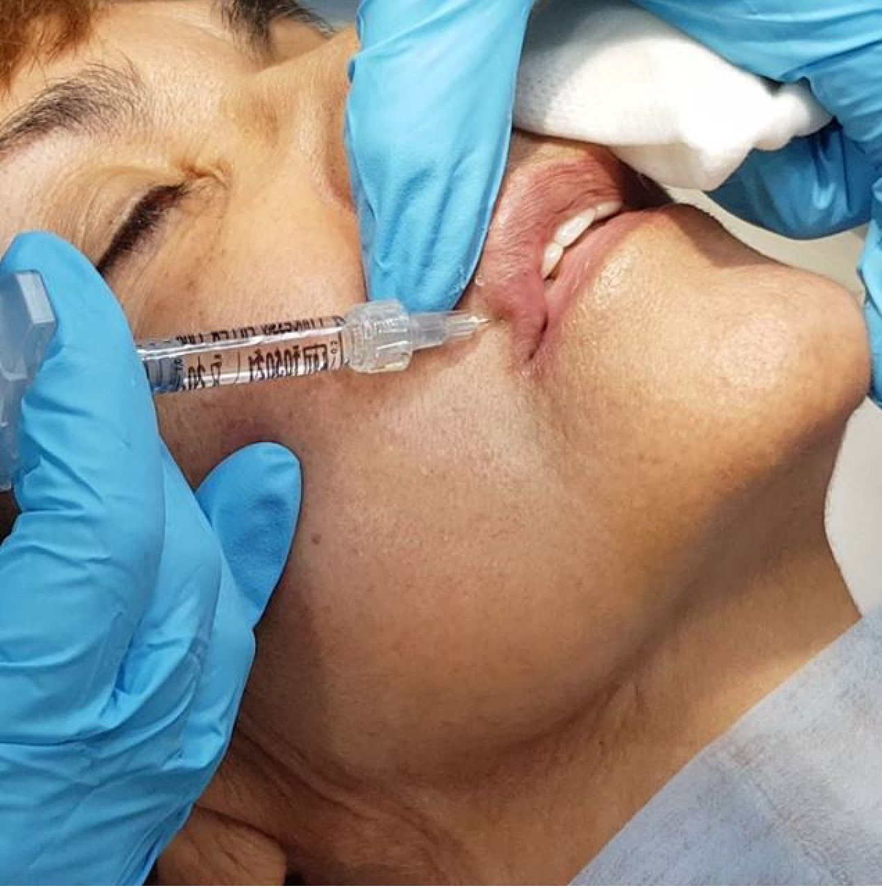 Rosalba Herrero Zerpa-416