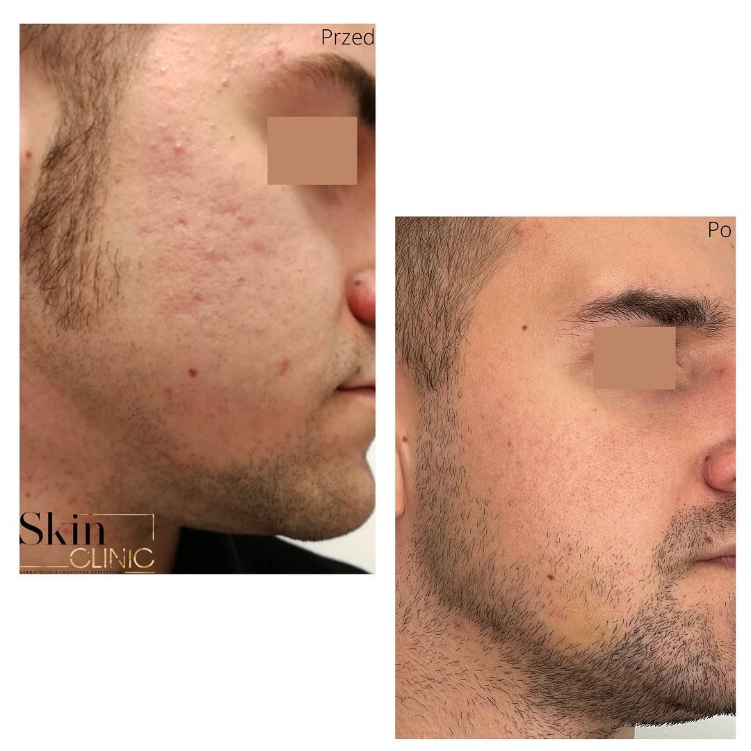 Alina Skrzypek-Salamon-6