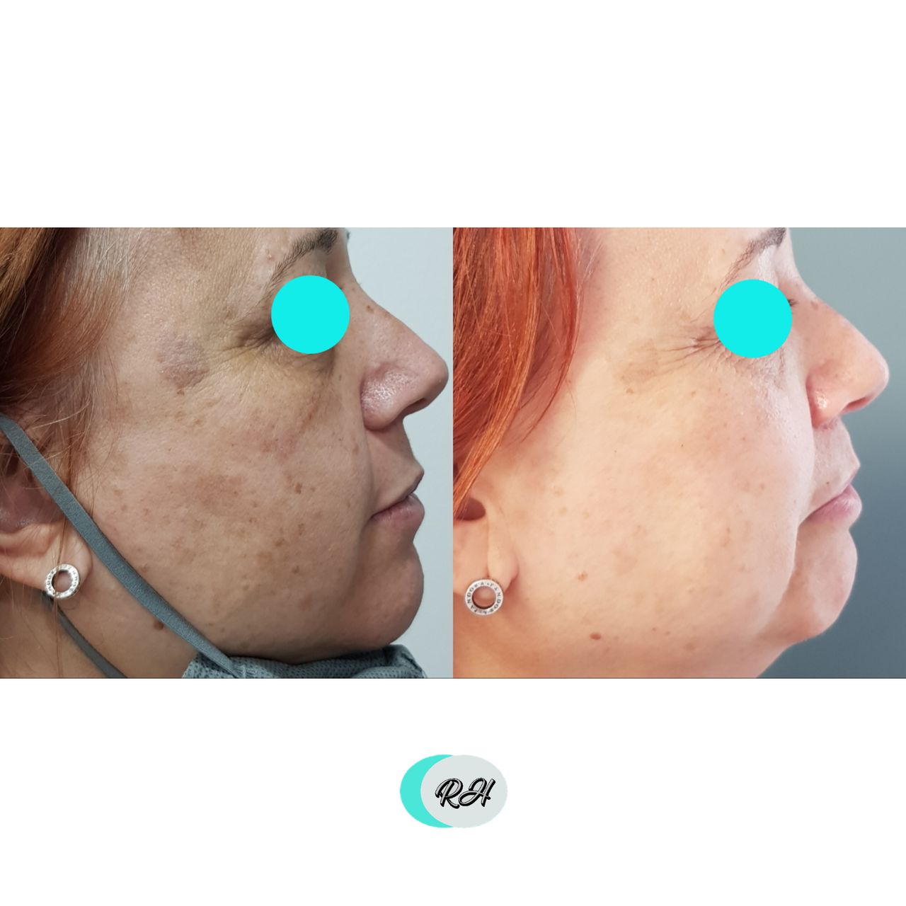 Rosalba Herrero Zerpa-182