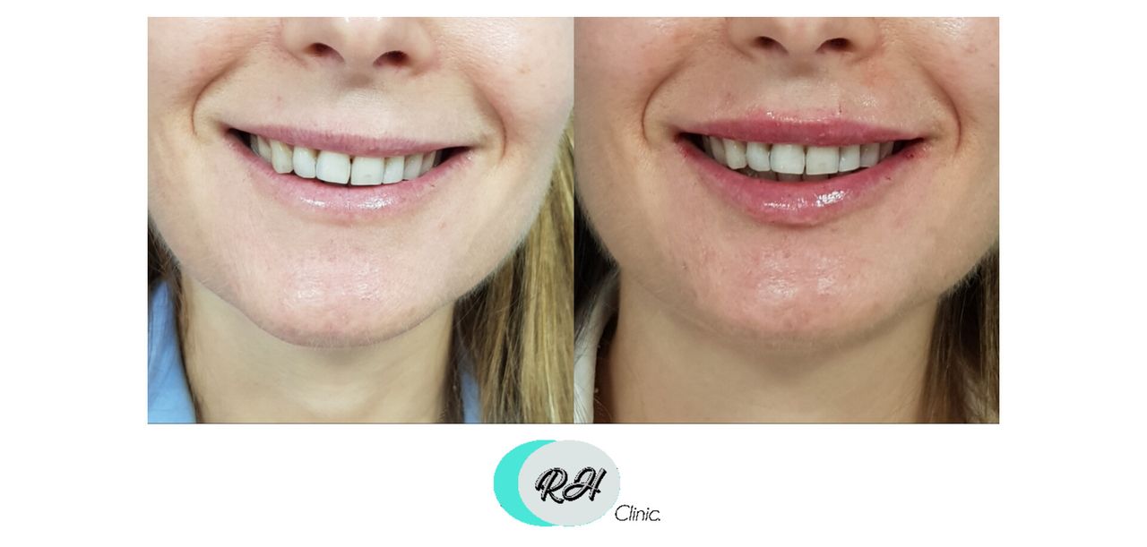 Rosalba Herrero Zerpa-625