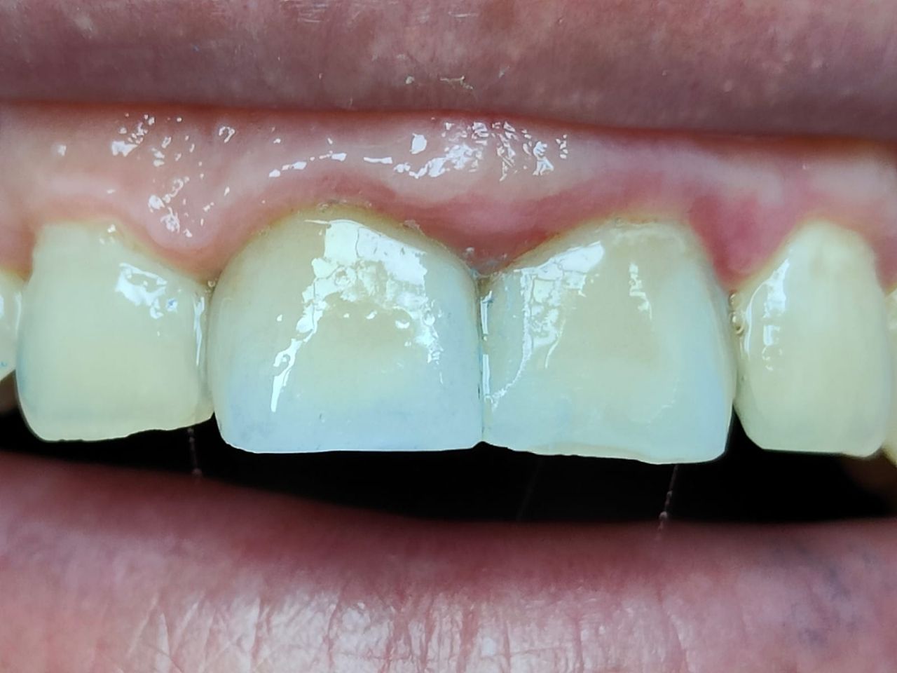 Stefano De Simone-123