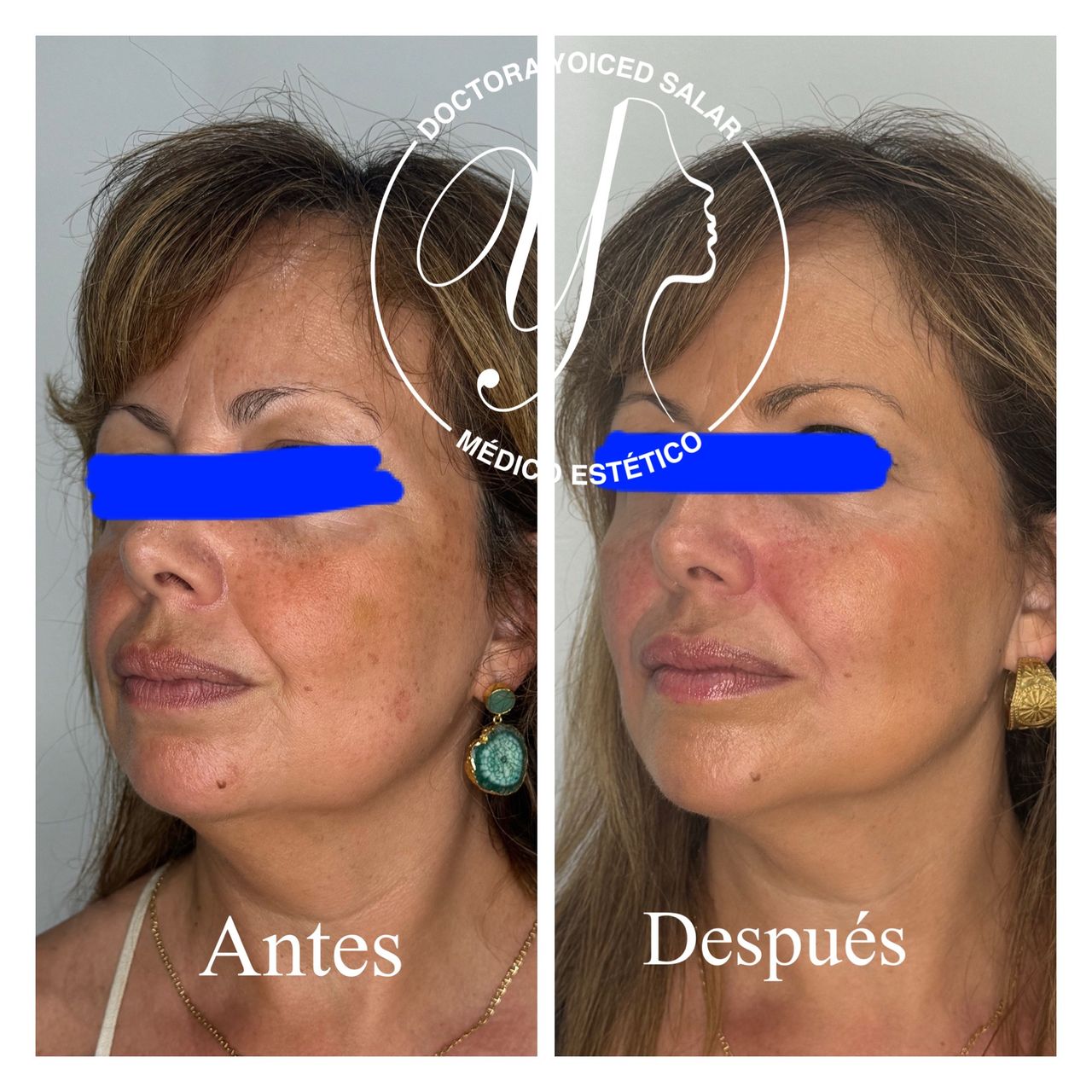 Yoiced Salar Peñate-33