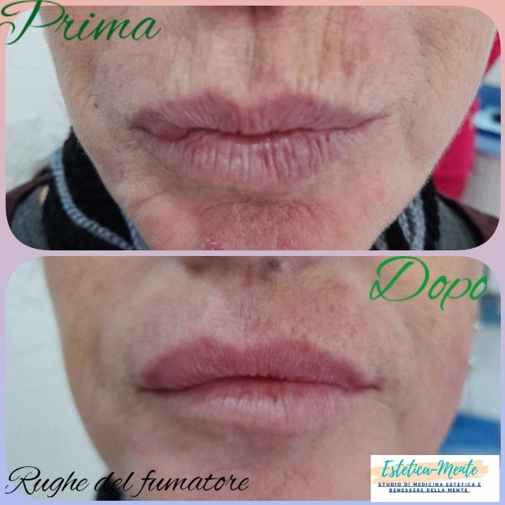 Paola Della Rocca-42