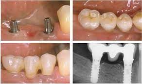 Paolo Bastianelli-25