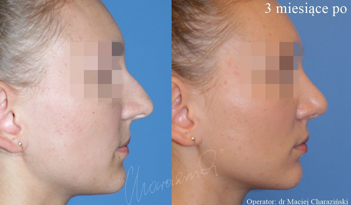 Maciej Charaziński-53