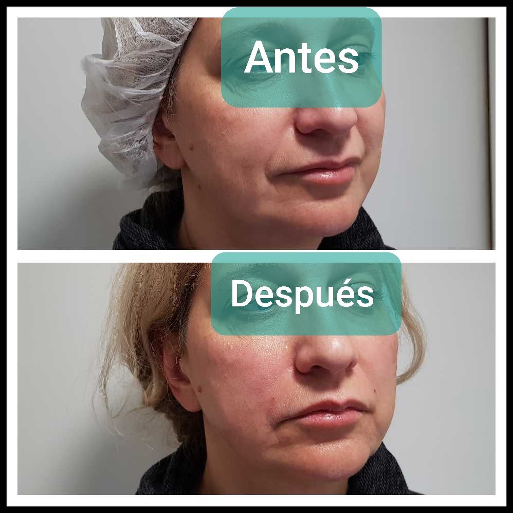 Rosalba Herrero Zerpa-345