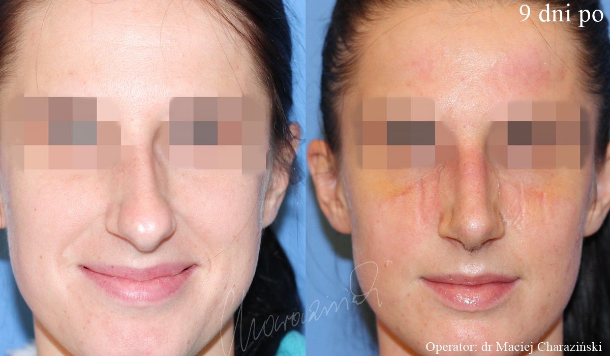 Maciej Charaziński-22