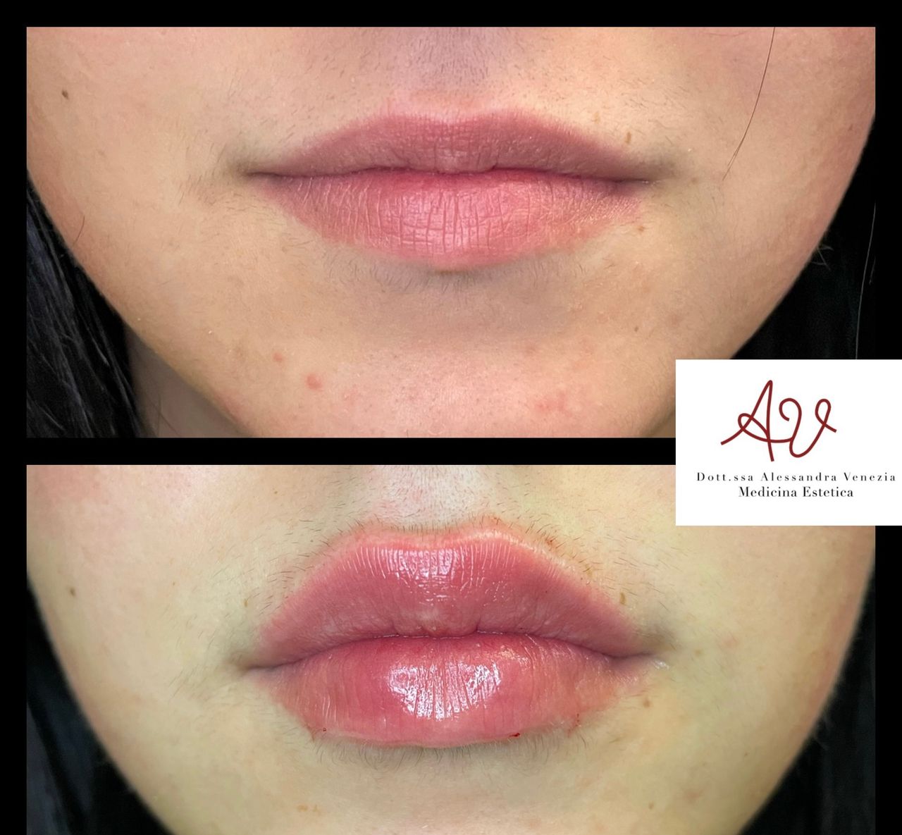 Alessandra Venezia-7