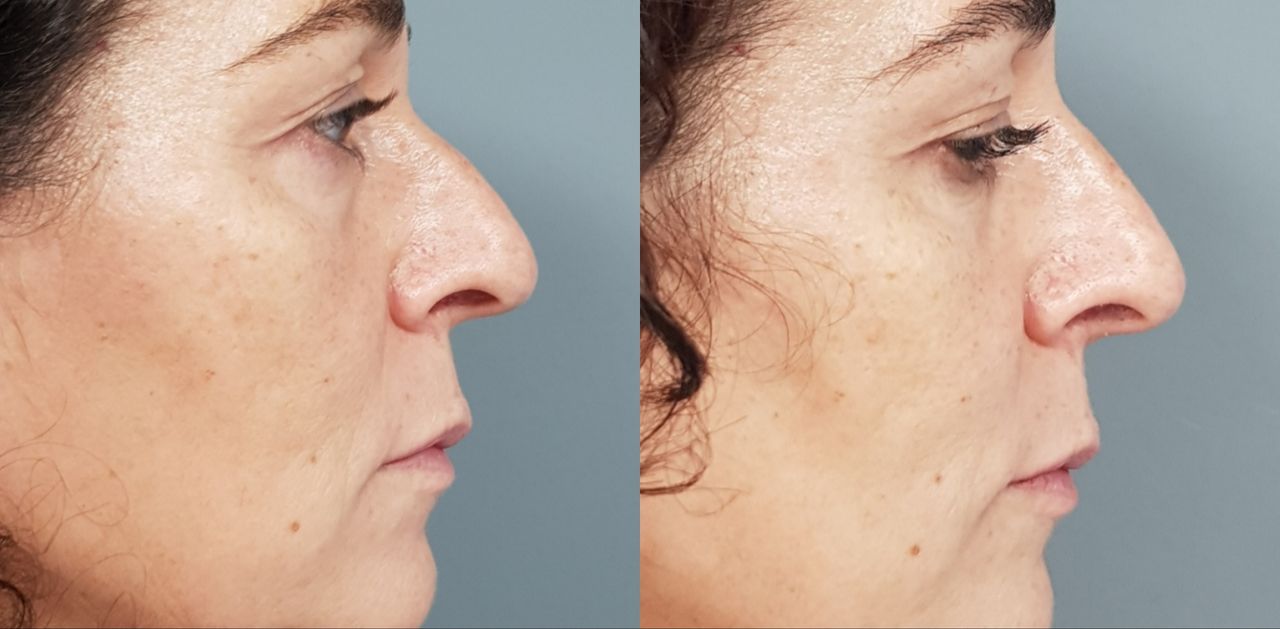 Rosalba Herrero Zerpa-492