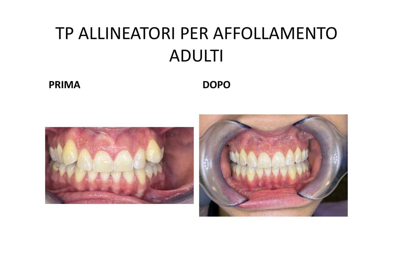 Raffaella Ferraris-14