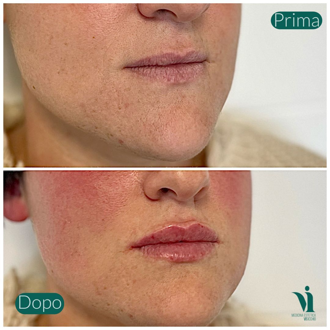 Annalisa Visicchio-0