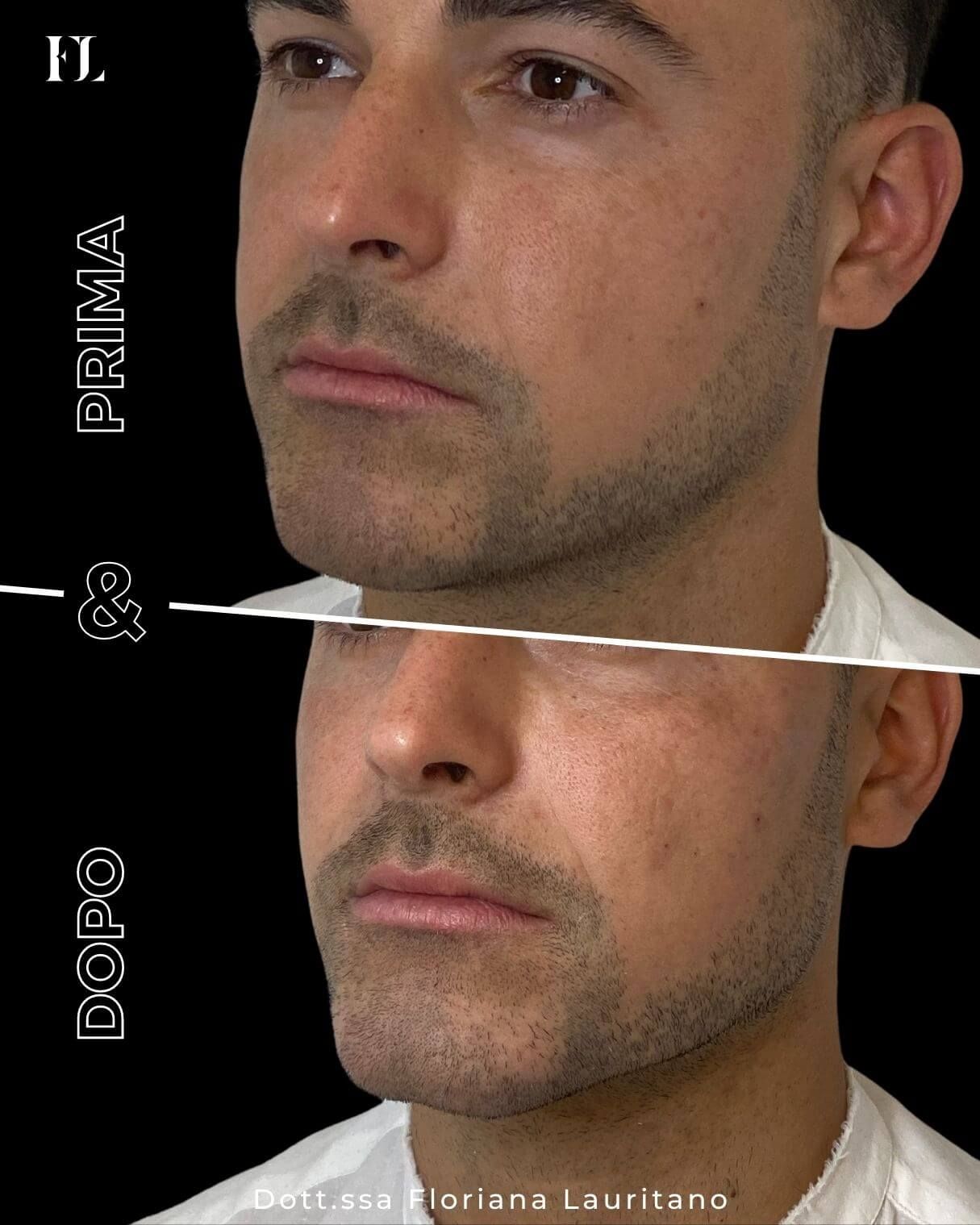 Floriana Lauritano-33