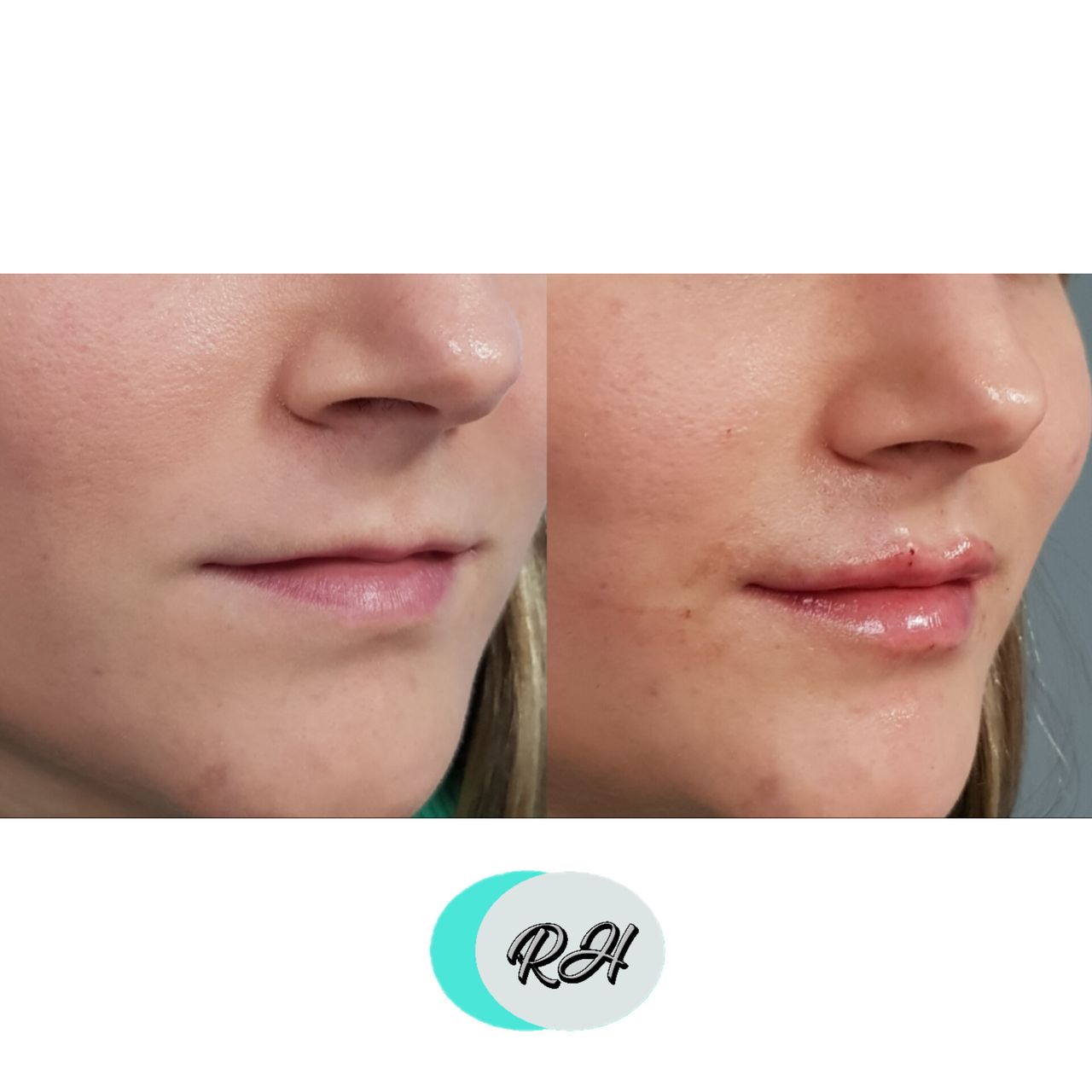 Rosalba Herrero Zerpa-148