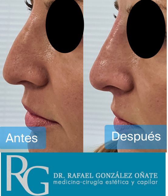 Rafael Gonzalez Oñate-7