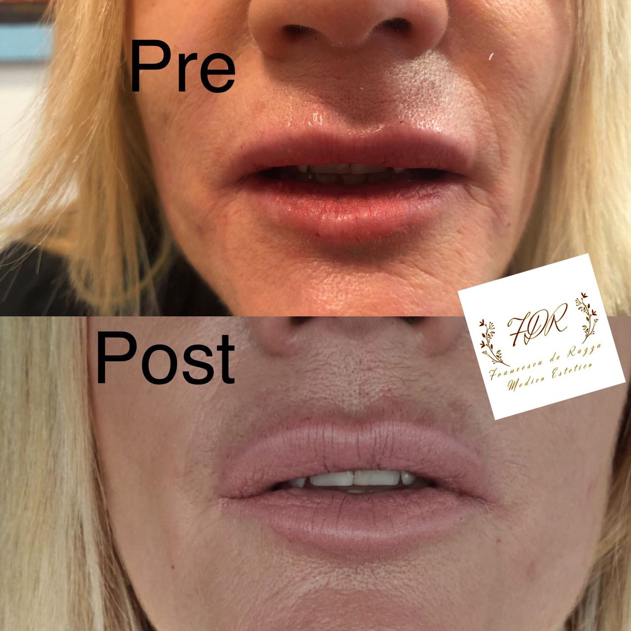 Francesca De Razza-40