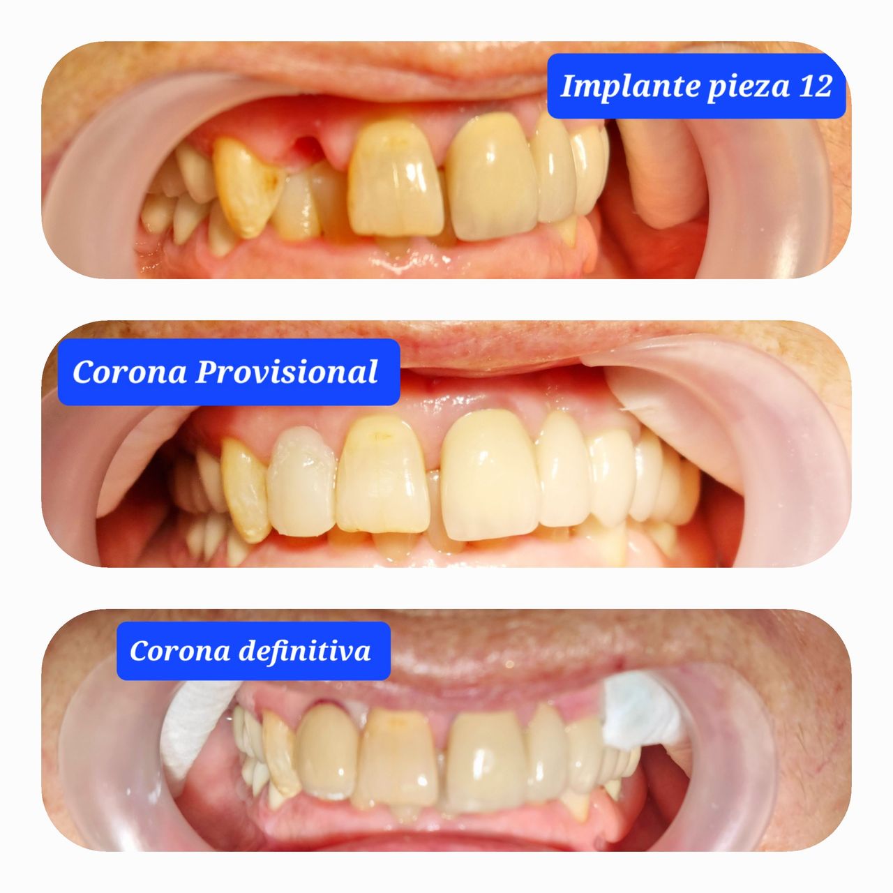 Arabel Fis Rodríguez-6