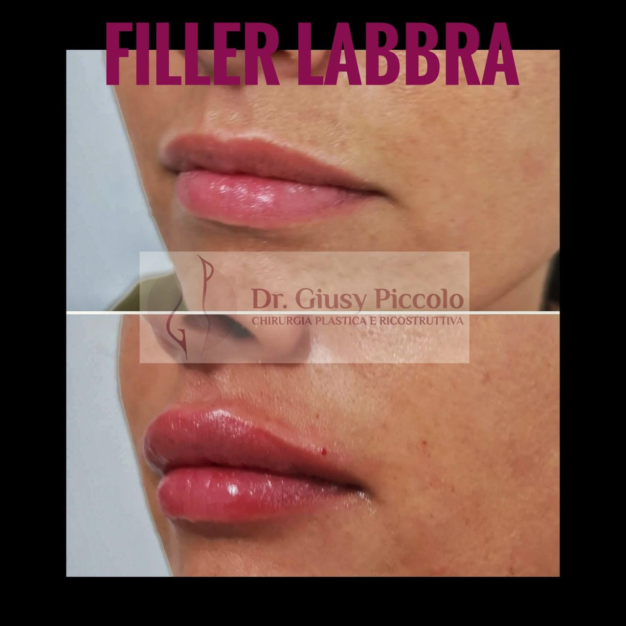 Giuseppina Piccolo-42