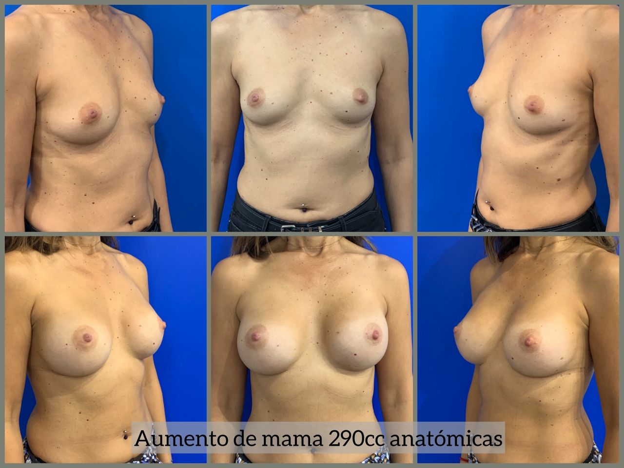 Ignacio Ortega Remirez-4