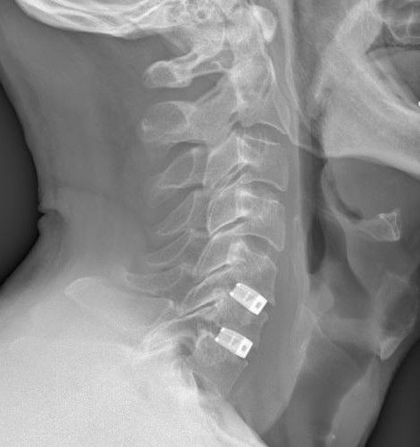 Alessandro Borderi-24