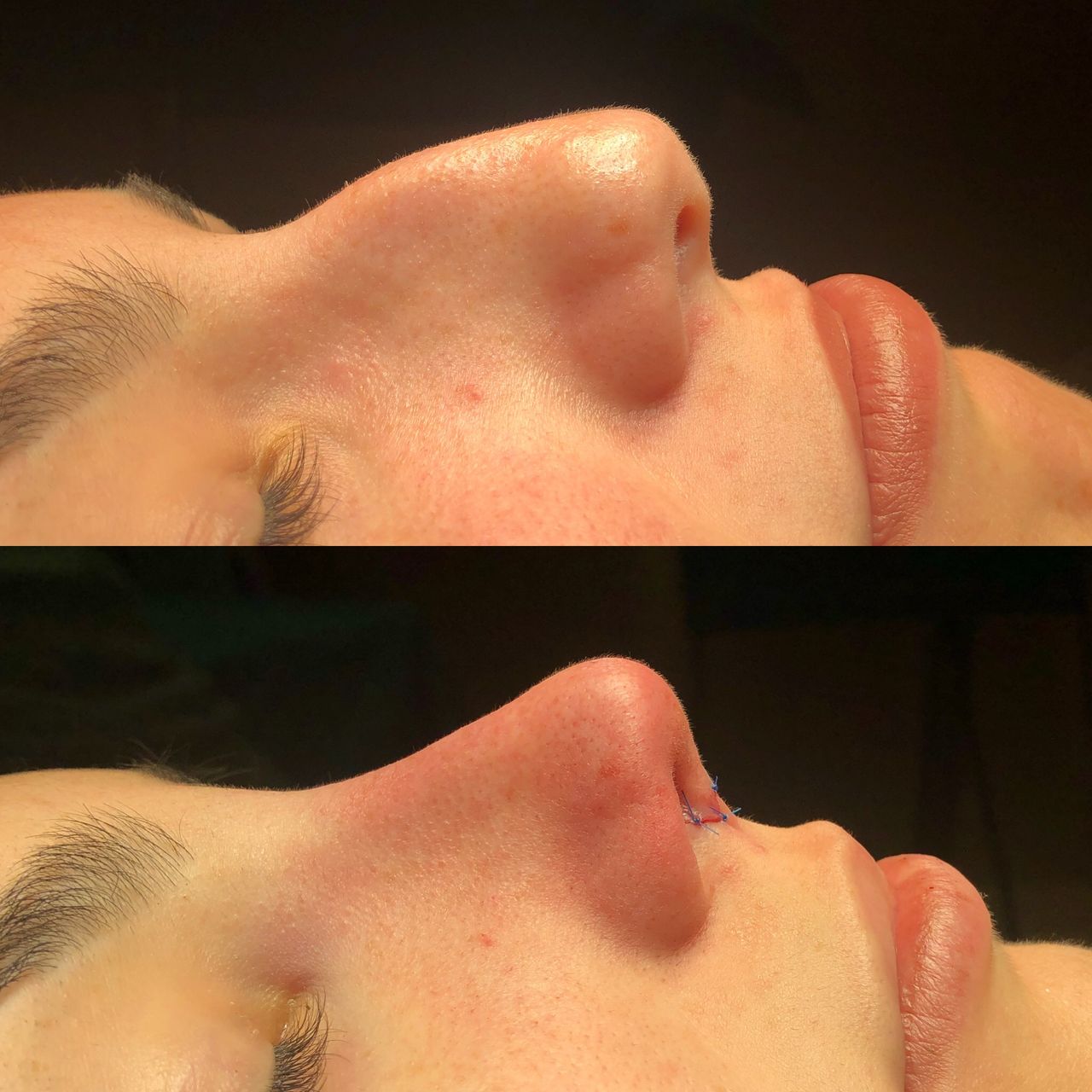 Alberto Candau Álvarez-29