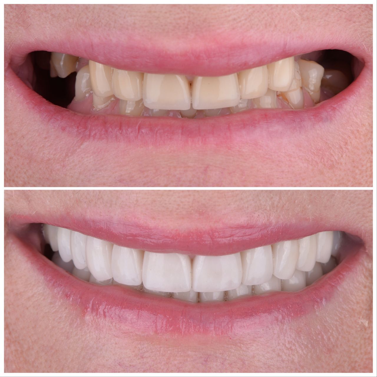 Martin Bartoszcze-19