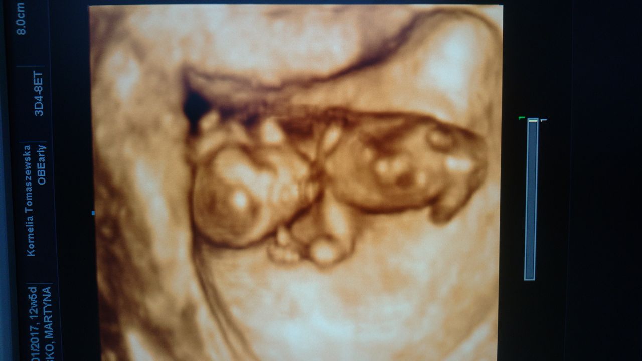 Kornelia Tomaszewska-7