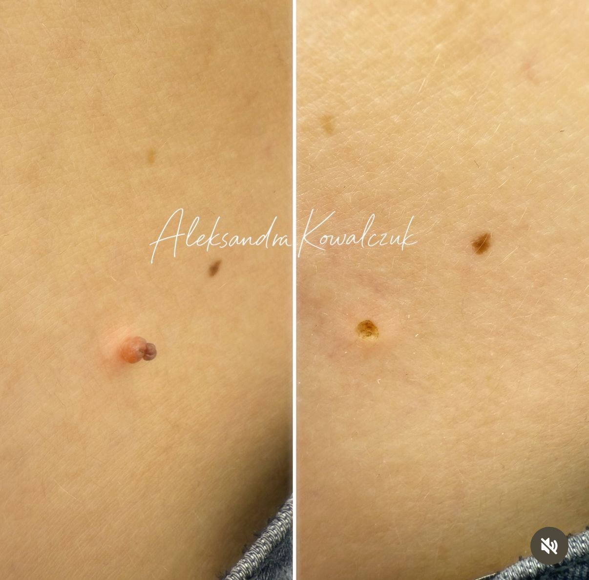 Aleksandra Kowalczuk-23