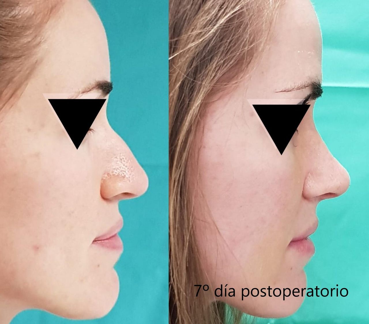 Enrique Bonanad Fernandez-10