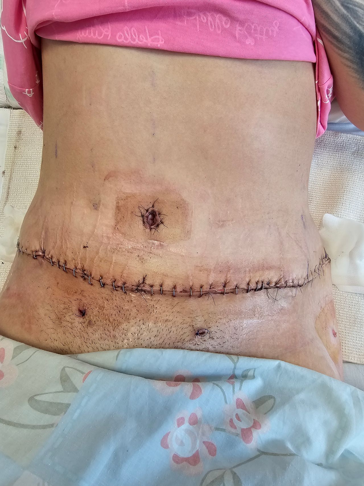 Bartłomiej  Staśkiewicz -5