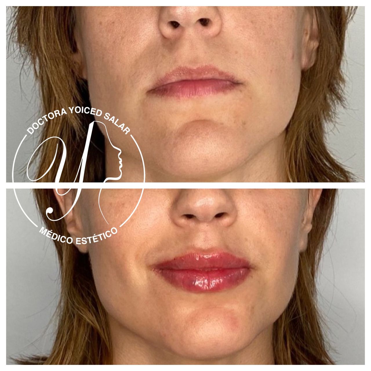 Yoiced Salar Peñate-11